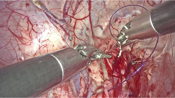 高精細なフルハイビジョン3Ⅾ画像